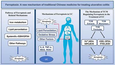 Ferroptosis: a new mechanism of traditional Chinese medicine for treating ulcerative colitis